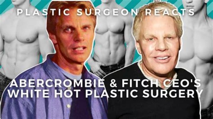 Mike Jeffries Abercrombie Plastic Surgery History: Before And After Photos Of His Face