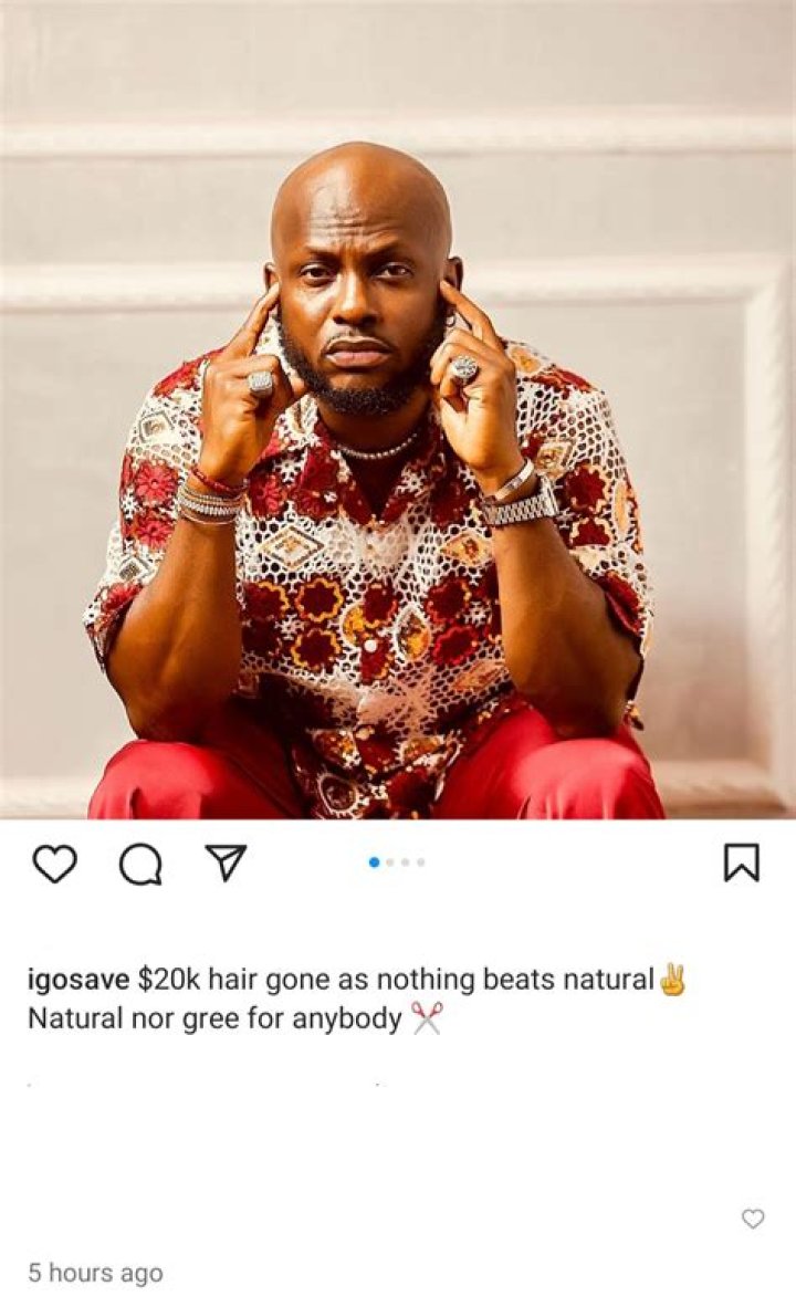 
Reactions As Nigerian Comedian, Igosave Spend 20k Dollars On Hair Transplant 